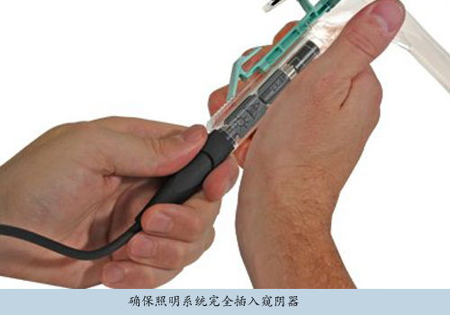 美國偉倫一次性帶電纜窺陰器照明系統78810及其變壓器配件詳解